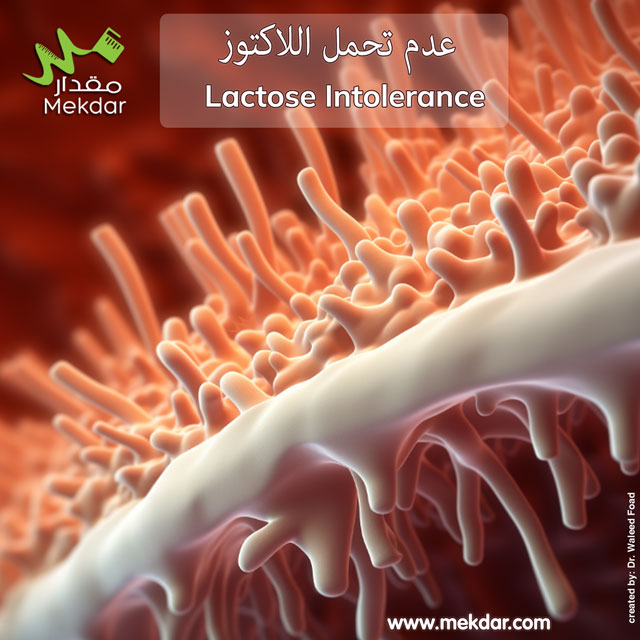 أعراض التحمل الغير لللاكتوز، أسبابه، تشخيصه، علاجه، والوقاية منه، احتياجات التغذية